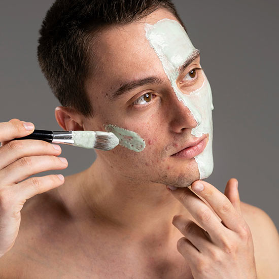 Acne Facial